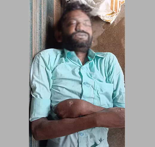 Unidentified body